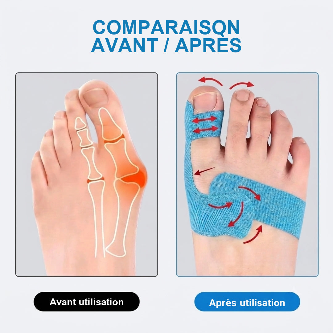 Comparaison avant et après